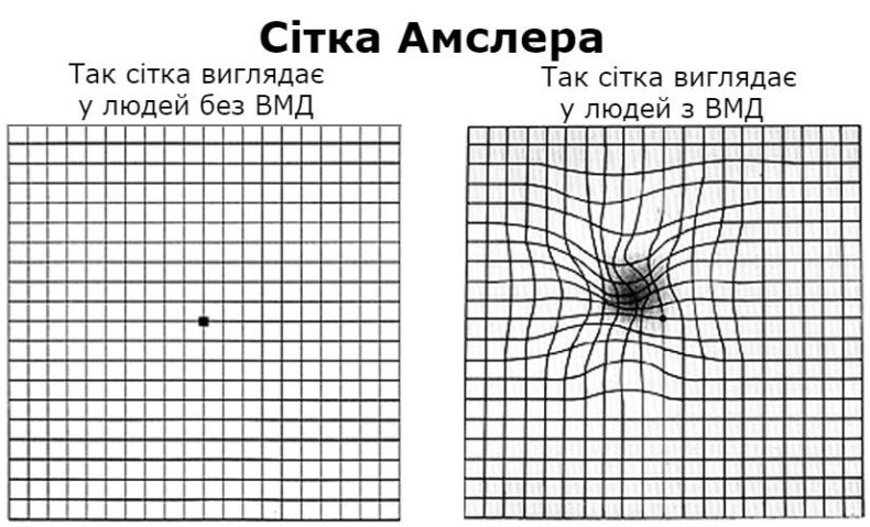 Виявлення ознак ВМД за допомогою сітки Амслера Виявлення ознак ВМД за допомогою сітки Амслера